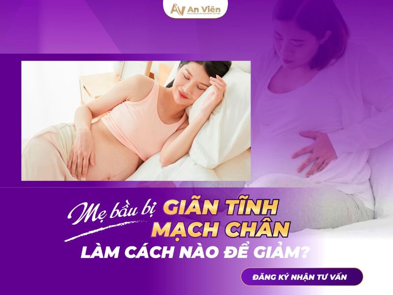 Dấu hiệu suy giãn tĩnh mạch chi dưới mẹ bầu: Phù chân 13 dấu hiệu suy giãn tĩnh mạch chi dưới
