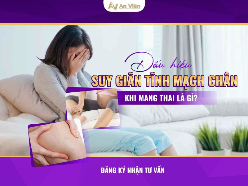 Dấu hiệu suy giãn tĩnh mạch chi dưới mẹ bầu: Phù chân 15 dấu hiệu suy giãn tĩnh mạch chi dưới