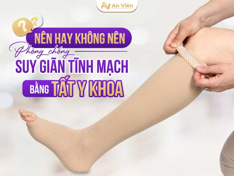 giãn tĩnh mạch là như thế nào