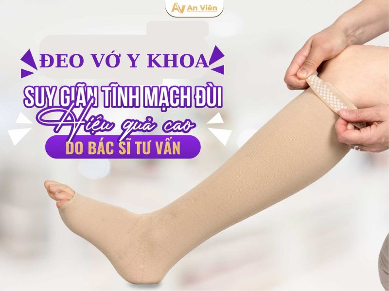giãn tĩnh mạch là như thế nào