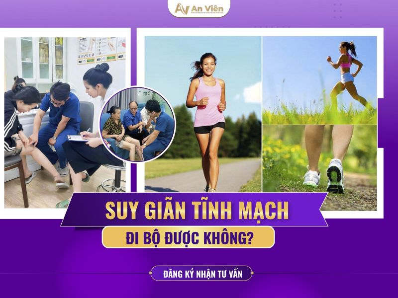 Lưu ngay 4 cách tập thể dục giãn tĩnh mạch 11 cách tập thể dục giãn tĩnh mạch