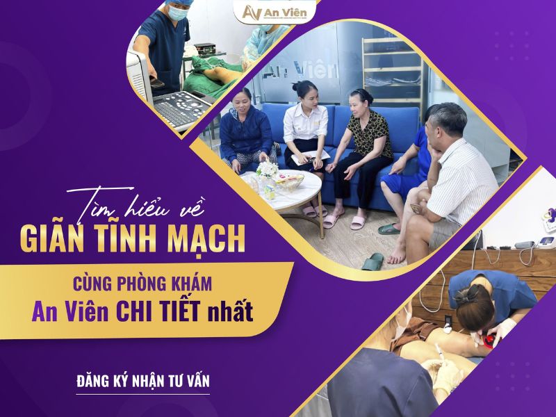 đau giãn tĩnh mạch chân