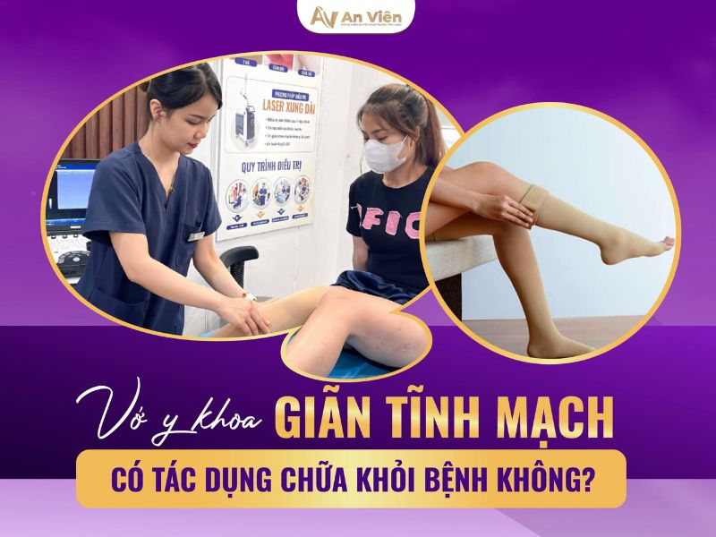 đau giãn tĩnh mạch chân