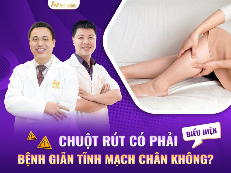 giãn tĩnh mạch nổi gân xanh