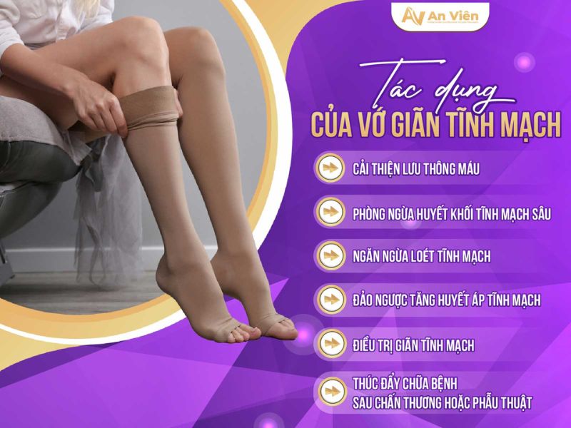 phòng ngừa bệnh suy giãn tĩnh mạch