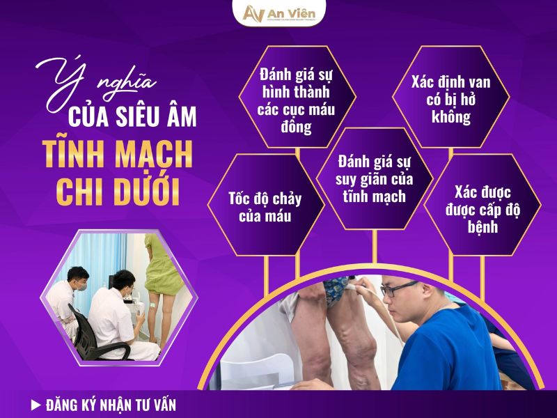 suy giãn tĩnh mạch chi dưới có nguy hiểm không