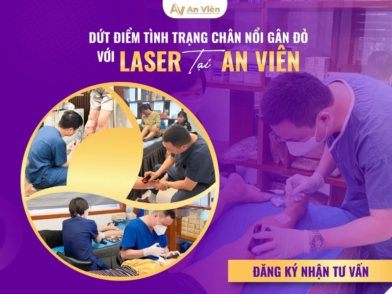 Tại sao giãn tĩnh mạch điều trị ở An Viên uy tín? 10 tại sao giãn tĩnh mạch