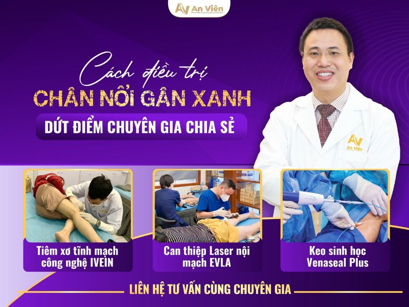 tay chân nhiều gân xanh