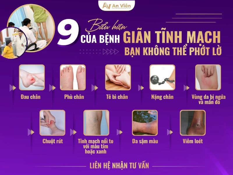 Tìm hiểu về bệnh giãn tĩnh mạch và 6 dấu hiệu bất thường 9 tìm hiểu về bệnh giãn tĩnh mạch