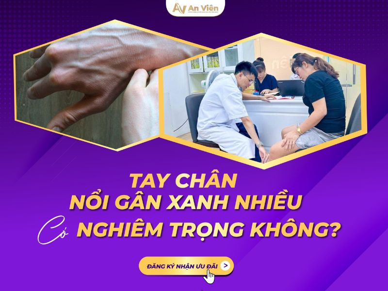 Nhận biết triệu chứng của suy giãn tĩnh mạch chân sớm 10 triệu chứng của suy giãn tĩnh mạch chân