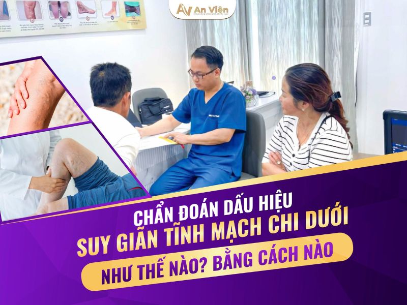 Nhận biết triệu chứng của suy giãn tĩnh mạch chân sớm 13 triệu chứng của suy giãn tĩnh mạch chân