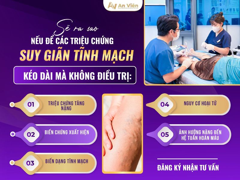 Triệu chứng suy giảm tĩnh mạch sẽ ra sao nếu để kéo dài? 15 triệu chứng suy giảm tĩnh mạch