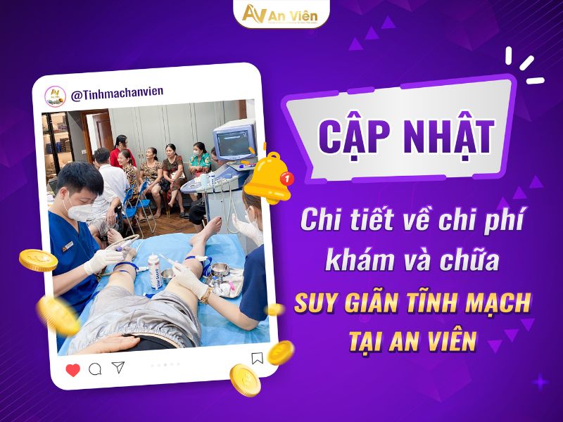 Điều trị bệnh suy tĩnh mạch ở chân tại An Viên bao nhiêu? 10 bệnh suy tĩnh mạch ở chân