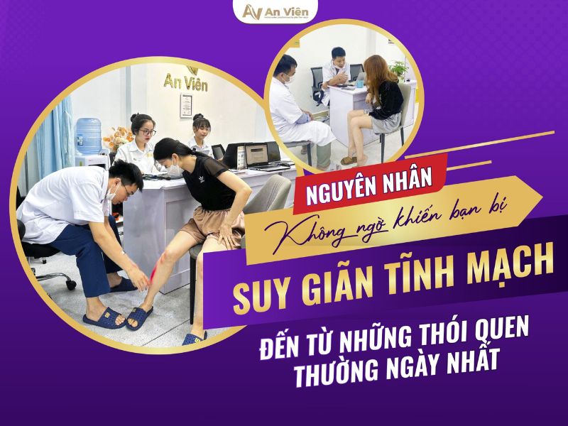 hình ảnh chân bị giãn tĩnh mạch