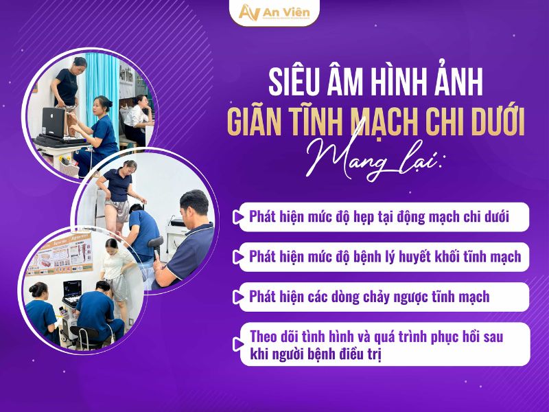 hình ảnh chân bị giãn tĩnh mạch