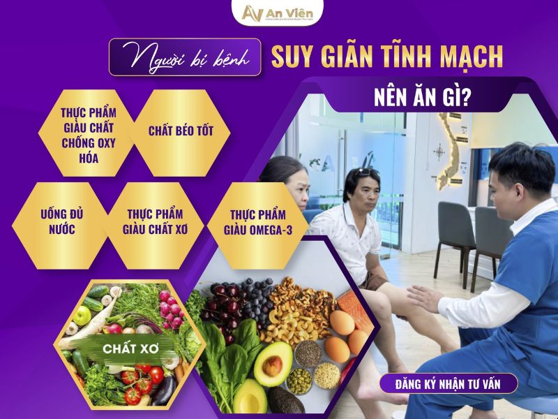 Ngăn ngừa giãn tĩnh mạch ở dân văn phòng qua 5 thói quen 13 ngăn ngừa giãn tĩnh mạch