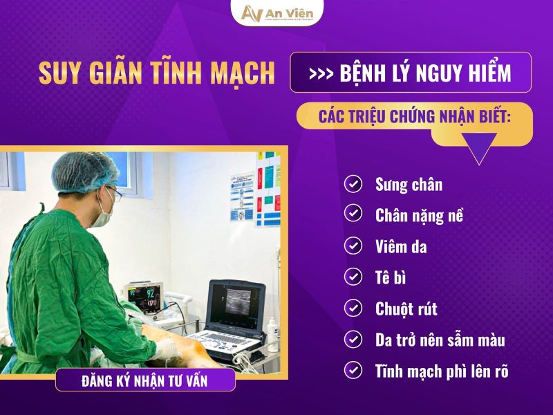 Ngăn ngừa giãn tĩnh mạch ở dân văn phòng qua 5 thói quen 15 ngăn ngừa giãn tĩnh mạch
