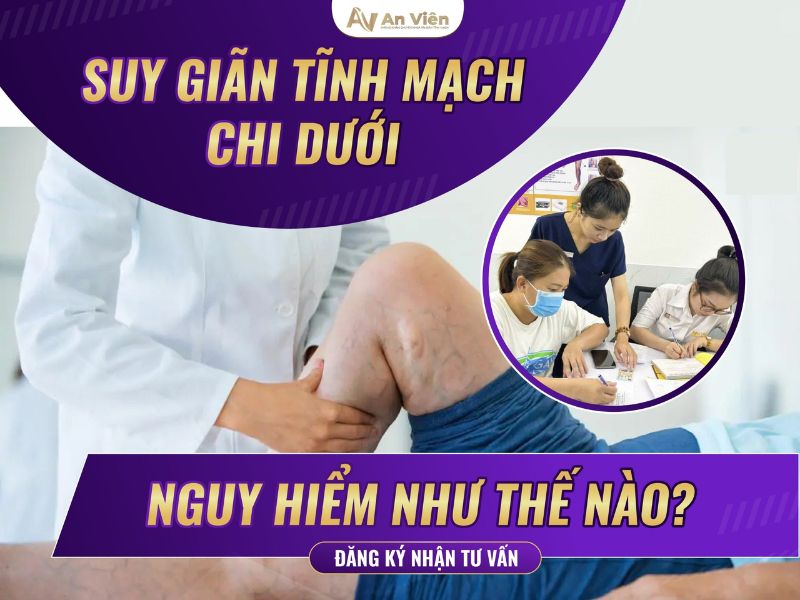 suy tĩnh mạch sâu là gì