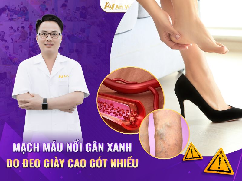 Tại sao bị giãn tĩnh mạch ở chân ở giới trẻ ngày càng nhiều? 9 Tại sao bị giãn tĩnh mạch ở chân