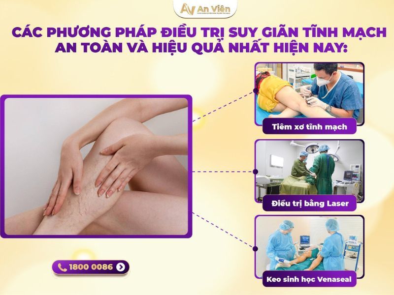 Lý do vì sao bị giãn tĩnh mạch chân? Bạn đã biết? 14 vì sao bị giãn tĩnh mạch chân