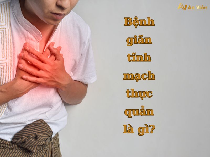 bệnh giãn tĩnh mạch thực quản