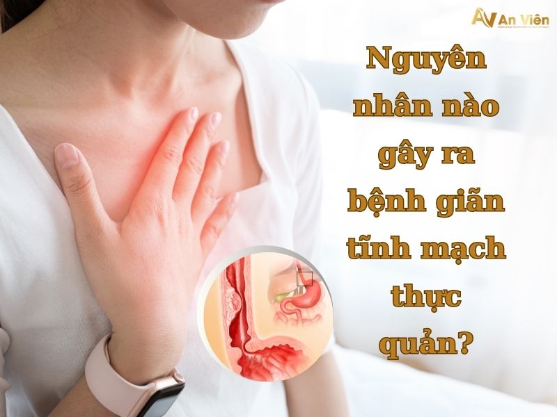 bệnh giãn tĩnh mạch thực quản