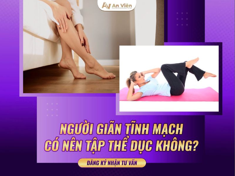 biểu hiện suy giãn tĩnh mạch
