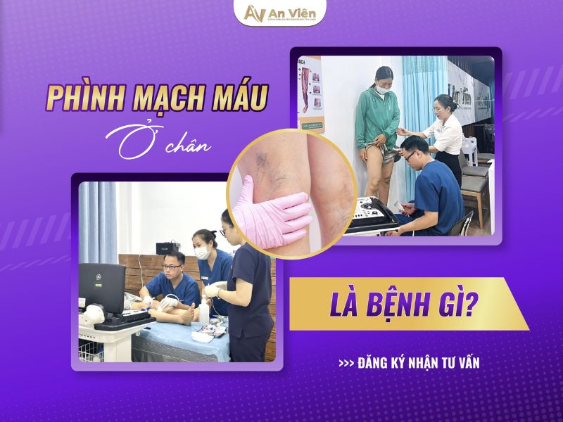 Chân nổi nhiều mạch máu nhỏ là bệnh gì? Điều trị triệt để 12 chân nổi nhiều mạch máu nhỏ