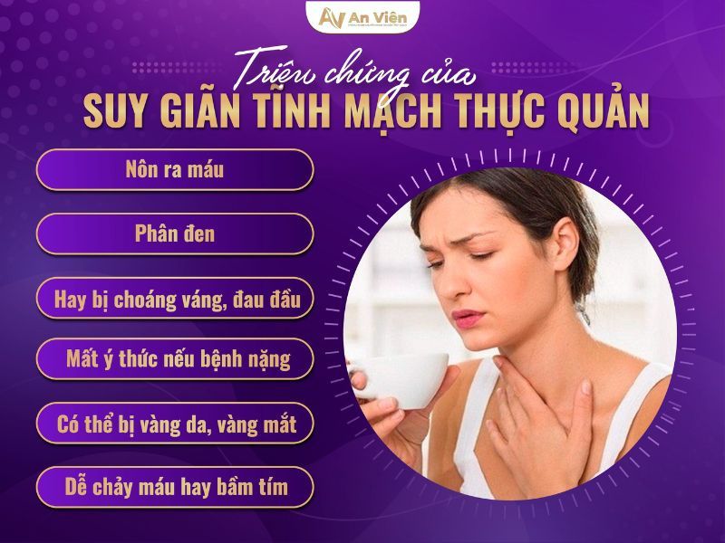 chế độ ăn cho người giãn tĩnh mạch thực quản