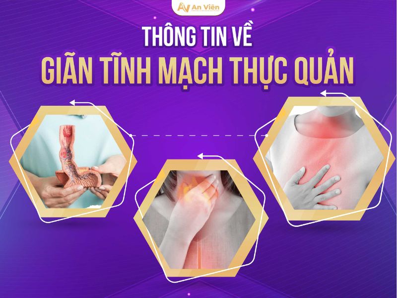 chế độ ăn cho người giãn tĩnh mạch thực quản