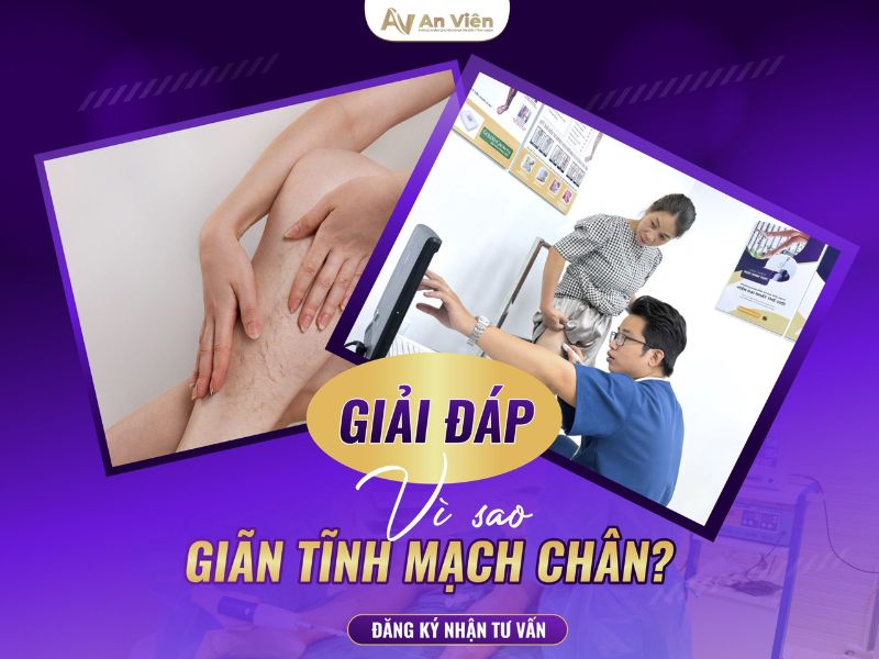 Tìm hiểu 2 nhóm nguyên nhân bị giãn tĩnh mạch ở chân 9 nguyên nhân bị giãn tĩnh mạch ở chân