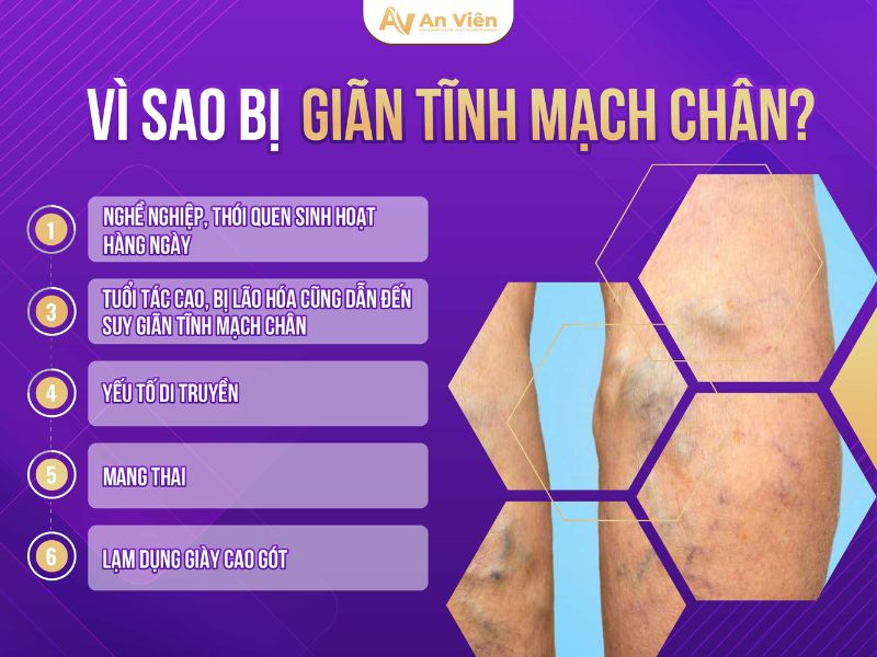 phình mạch máu ở chân