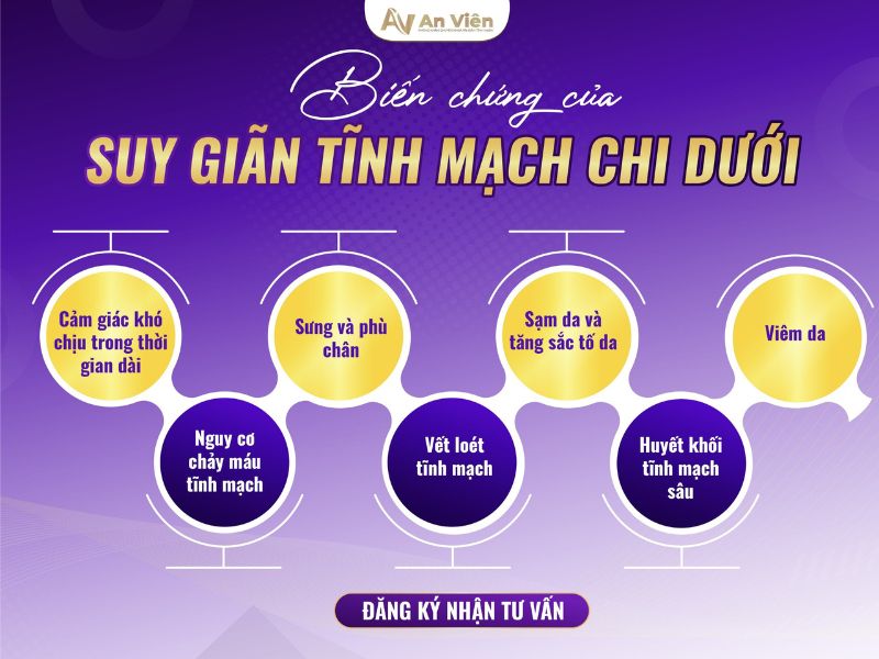 phình mạch máu ở chân