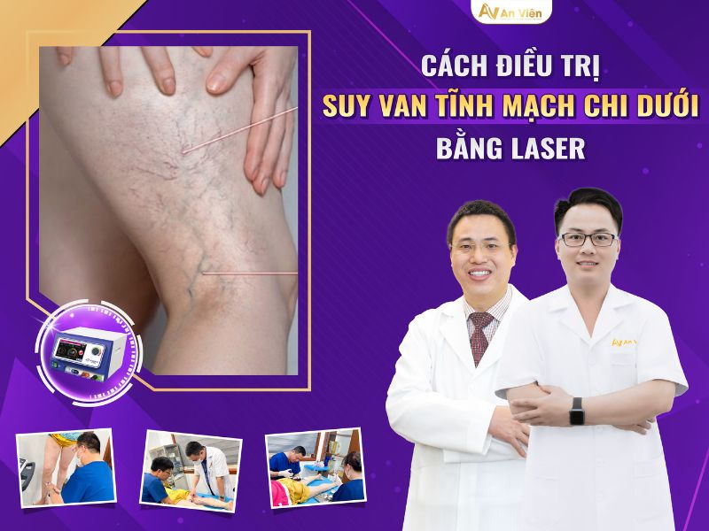 phình mạch máu ở chân