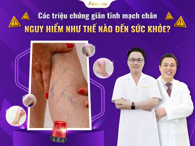 bệnh viêm tắc tĩnh mạch
