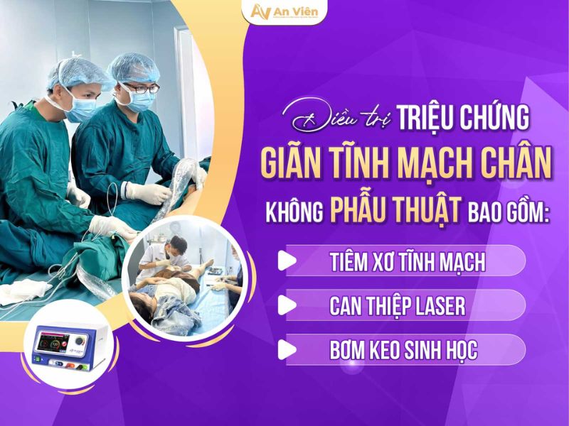 bệnh viêm tắc tĩnh mạch
