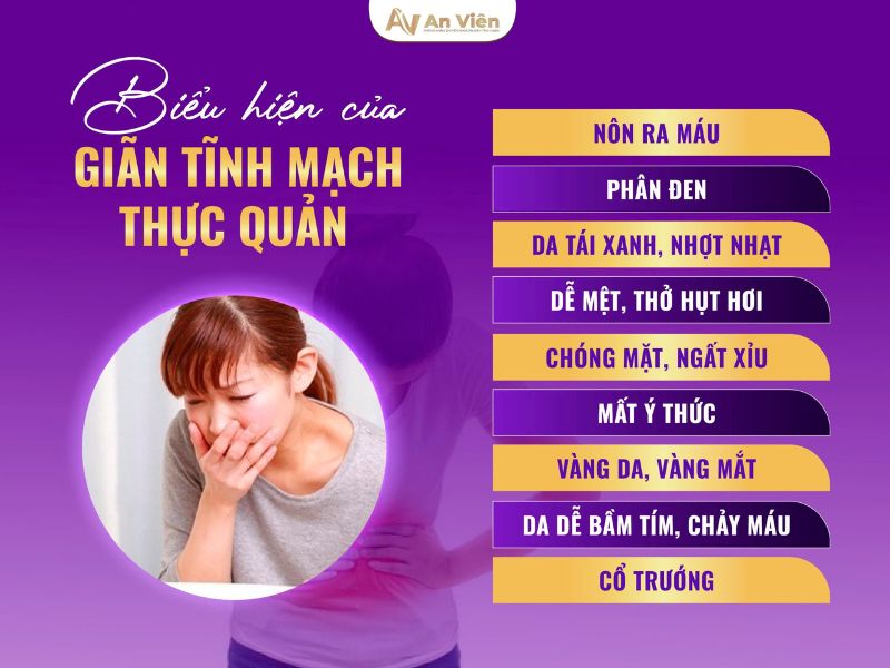 Giãn tĩnh mạch thực quản độ 2 là gì? Nguyên nhân, cách chữa 12 giãn tĩnh mạch thực quản độ 2