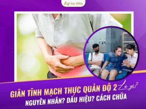 giãn tĩnh mạch thực quản độ 2