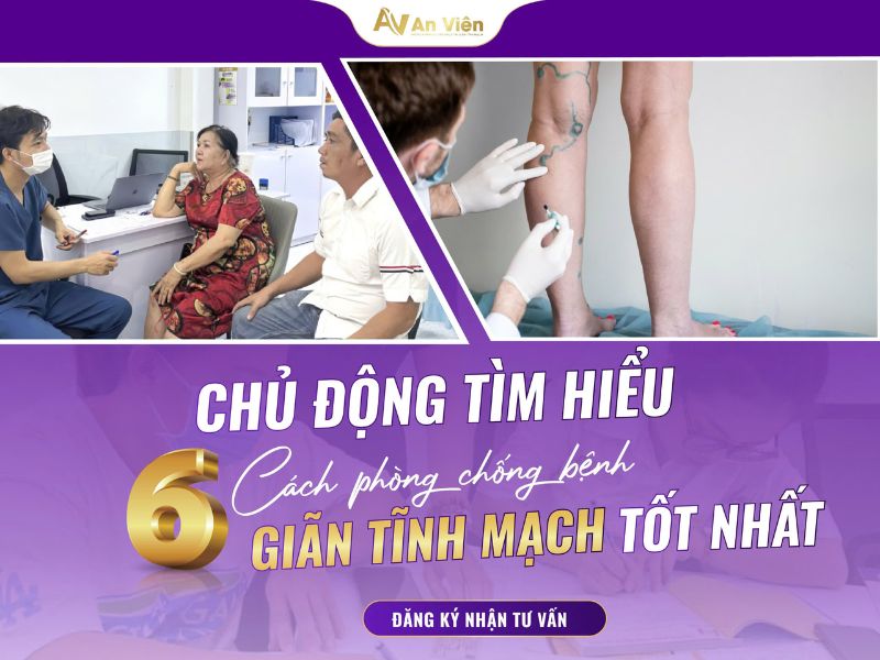 phình tĩnh mạch chân