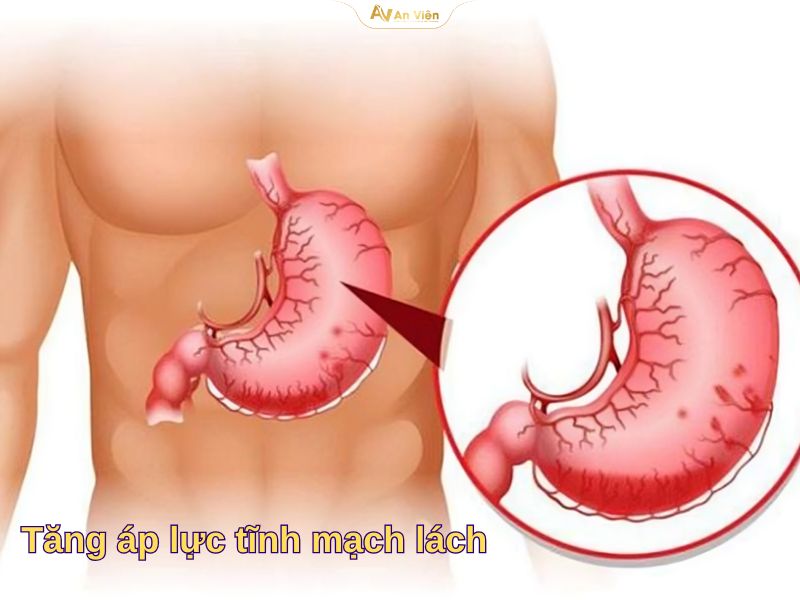 Tĩnh mạch lách