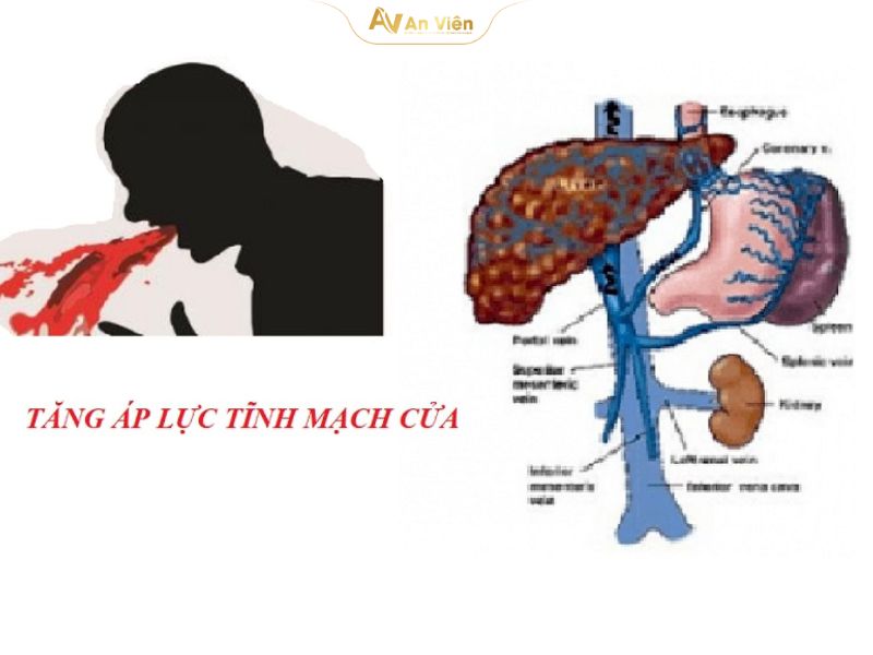 Tĩnh mạch gánh là gì và những vấn đề cần lưu ý 12 tĩnh mạch gánh
