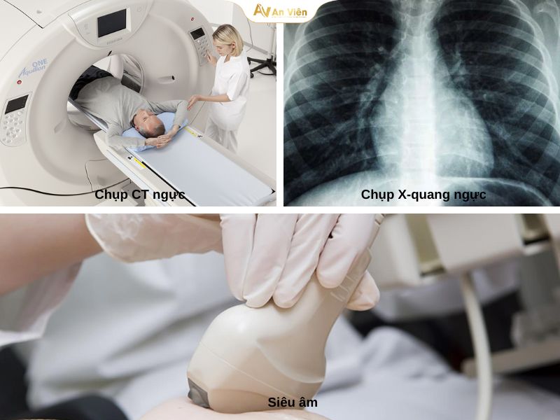 Tĩnh mạch azygos là gì? Những thông tin bạn đọc cần biết 8 Tĩnh mạch Azygos