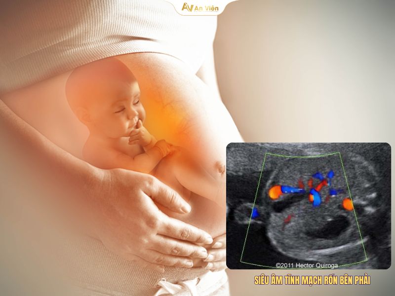 Tĩnh mạch rốn là gì? Điều trị như thế nào và cách phòng ngừa hiệu quả 10 Tĩnh mạch rốn
