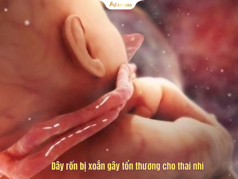 Tĩnh mạch rốn là gì? Điều trị như thế nào và cách phòng ngừa hiệu quả 11 Tĩnh mạch rốn