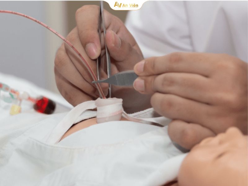 Tìm hiểu kỹ thuật đặt catheter tĩnh mạch rốn trẻ sơ sinh 8 Tĩnh mạch rốn trẻ sơ sinh