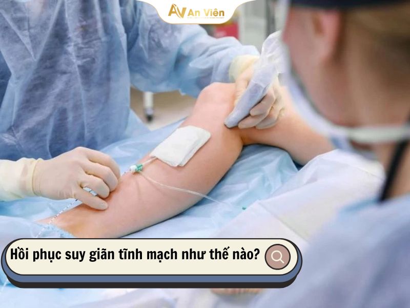 Chữa suy giãn tĩnh mạch tại An Viên