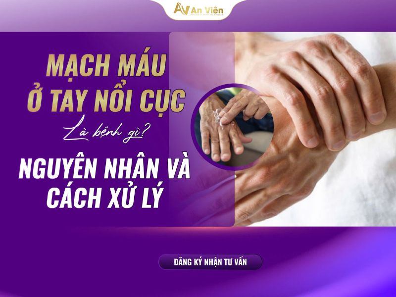 mạch máu ở tay nổi cục
