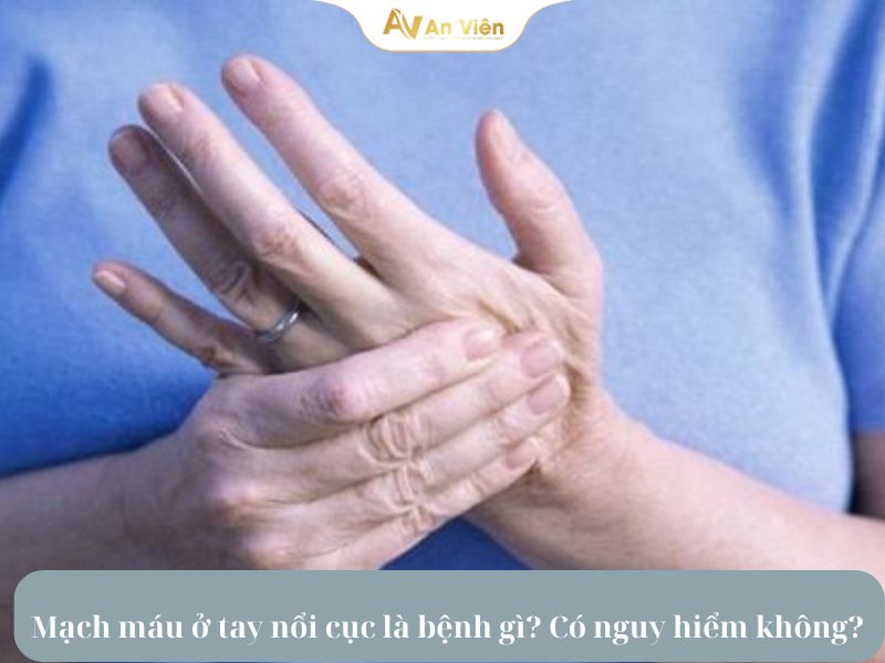 mạch máu ở tay nổi cục