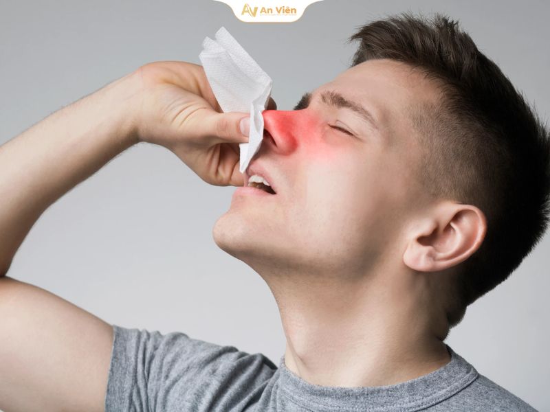 Giãn mạch máu mũi là gì? Nguyên nhân và cách khắc phục 11 Mạch máu mũi
