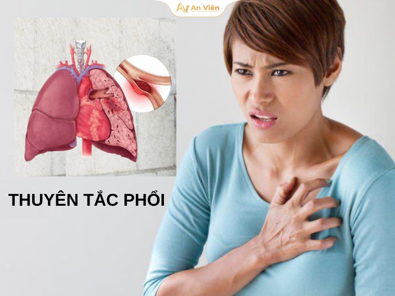 Tắc nghẽn mạch máu: Nguyên nhân, dấu hiệu và cách phòng ngừa 19 Tắc nghẽn mạch máu